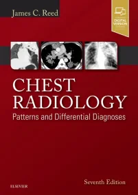 Chest Radiology: Patterns and Differential Diagnos...