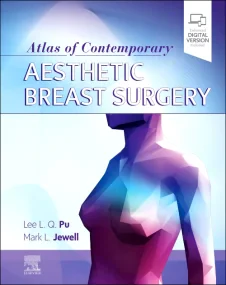 Atlas of Contemporary Aesthetic Breast Surgery: A ...