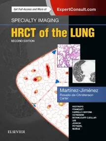 Specialty Imaging: HRCT of the Lung, 2e