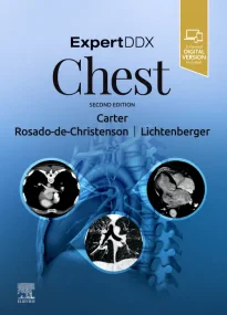 ExpertDDx: Chest, 2nd Edition
