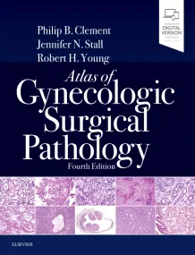 Atlas of Gynecologic Surgical Pathology, 4th Editi...