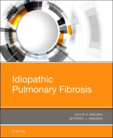 Idiopathic Pulmonary Fibrosis, 1e