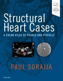 Structural Heart Cases: A Color Atlas of Pearls an...