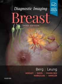 Diagnostic Imaging: Breast, 3rd Edition