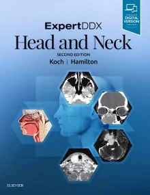 ExpertDDX: Head and Neck, 2e