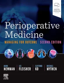 Perioperative Medicine: Managing for Outcome