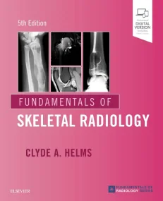 Fundamentals of Skeletal Radiology 