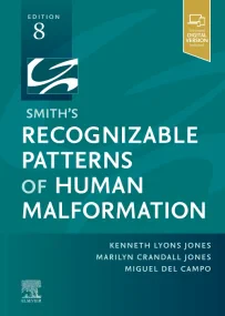 Smith's Recognizable Patterns of Human Malformatio...