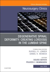 Degenerative Spinal Deformity: Creating Lordosis i...