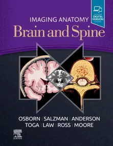 Imaging Anatomy Brain and Spine 