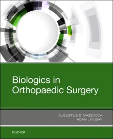Biologics in Orthopaedic Surgery, 1e
