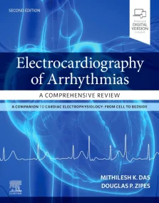 Electrocardiography of Arrhythmias: A Comprehensiv...