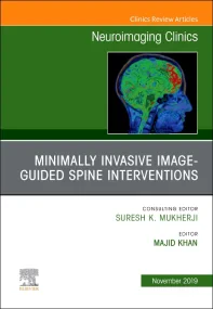 Spine Intervention, An Issue of Neuroimaging Clini...