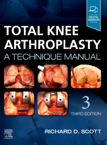 Total Knee Arthroplasty, 3rd Edition