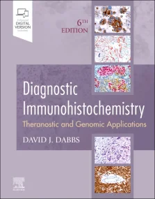 Diagnostic Immunohistochemistry: Theranostic and G...