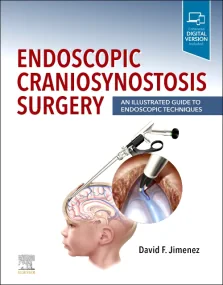 Endoscopic Craniosynostosis Surgery