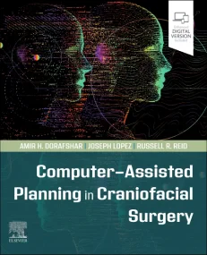Computer-Assisted Planning in Craniofacial Surgery