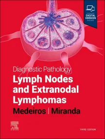 Diagnostic Pathology: Lymph Nodes and Extranodal L...