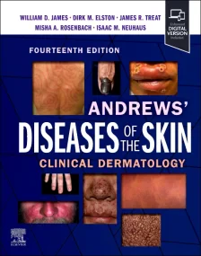 Andrews' Diseases of the Skin: Clinical Dermatolog...
