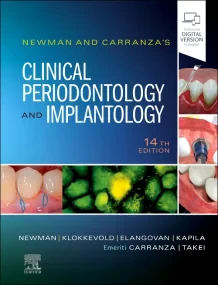 Newman and Carranza’s Clinical Periodontology and ...