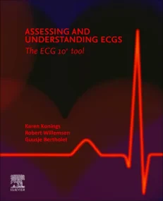 Assessing and Understanding ECGs: The ECG10+ tool