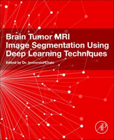 Brain Tumor MRI Image Segmentation Using Deep Lear...