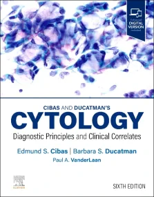 Cibas and Ducatman's Cytology: Diagnostic Principl...
