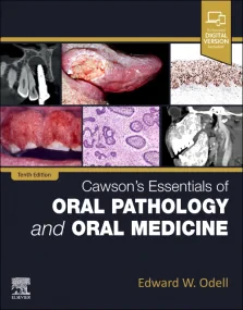 Cawson’s Essentials of Oral Pathology and Oral Med...