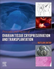 Principles and Practice of Ovarian Tissue Cryopres...