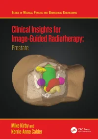 Clinical Insights for Image-Guided Radiotherapy: P...
