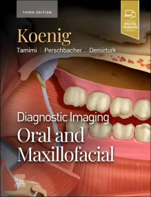 Diagnostic Imaging: Oral and Maxillofacial, 3rd Ed...