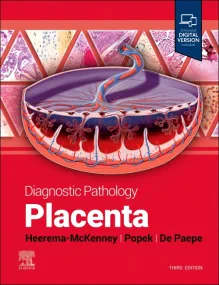 Diagnostic Pathology: Placenta, 3e