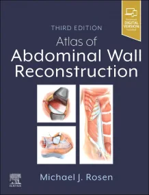 Atlas of Abdominal Wall Reconstruction 3rd Edition