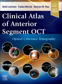 Clinical Atlas of Anterior Segment OCT: Optical Co...
