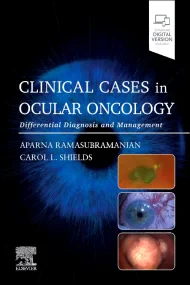 Clinical Cases in Ocular Oncology: Differential Di...