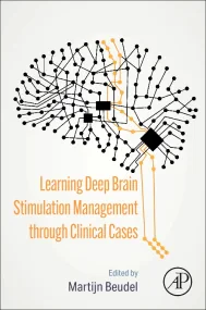 Learning Deep Brain Stimulation Management through...