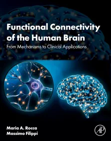 Functional Connectivity of the Human Brain
