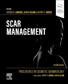 Procedures in Cosmetic Dermatology: Scar Managemen...