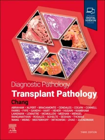 Diagnostic Pathology: Transplant Pathology, 3rd Ed...