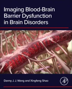 Imaging Blood-Brain Barrier Dysfunction in Brain D...