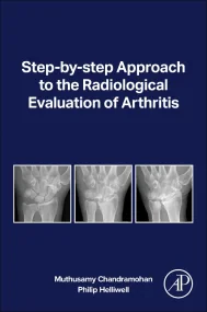 Step-by-step Approach to the Radiological Evaluati...