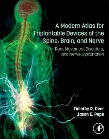 A Modern Atlas for Implantable Devices of the Spin...