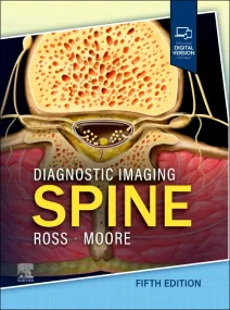 Diagnostic Imaging: Spine 5th Edition