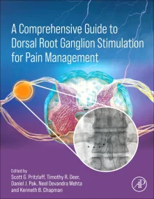 A Comprehensive Guide to Dorsal Root Ganglion Stim...