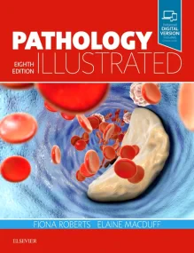 Pathology Illustrated, 8e