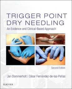 Trigger Point Dry Needling: An Evidence and Clinic...