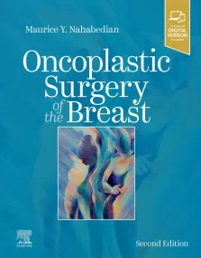Oncoplastic Surgery of the Breast, 2nd Edition