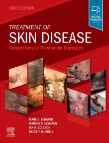 Treatment of Skin Disease: Comprehensive Therapeut...