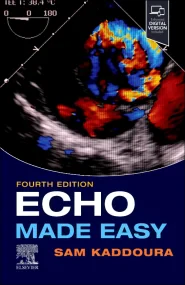 Echo Made Easy