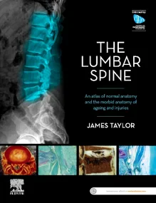 The Lumbar Spine
